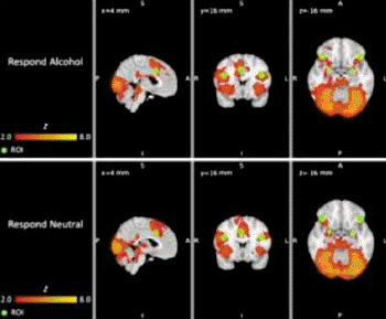 Image: Brain regions of interest (green) and group-level brain activity (red-yellow); data were averaged across three fMRI sessions and overlaid on a standard brain template (Photo courtesy of Penn State). Image: Brain regions of interest (green) and group-level brain activity (red-yellow); data were averaged across three fMRI sessions and overlaid on a standard brain template (Photo courtesy of Penn State).